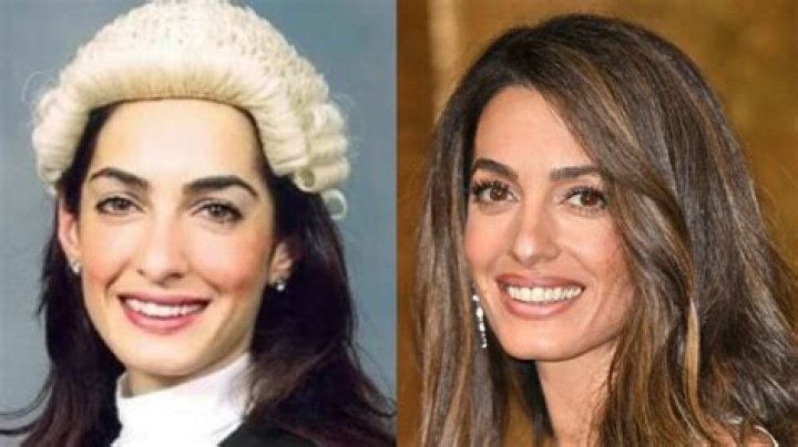 Amal Clooney: A Glimpse Before Surgery