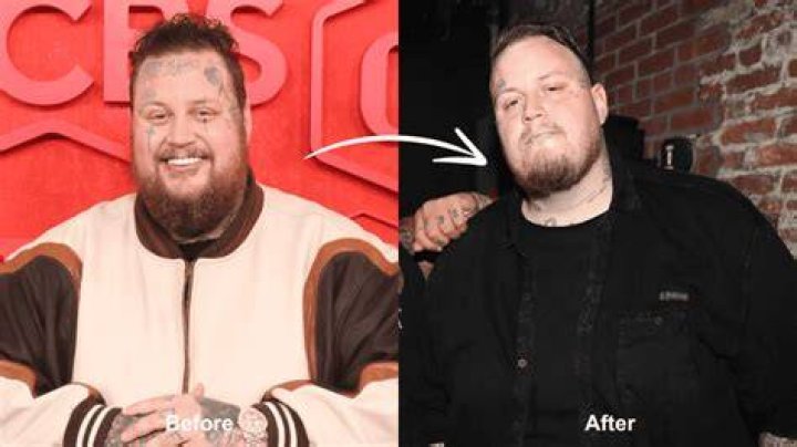 Did He Get Surgery to Lose Weight?