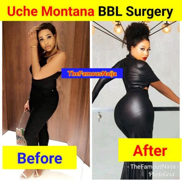 Height, Parents, Net Worth, Plastic Surgery, Age
