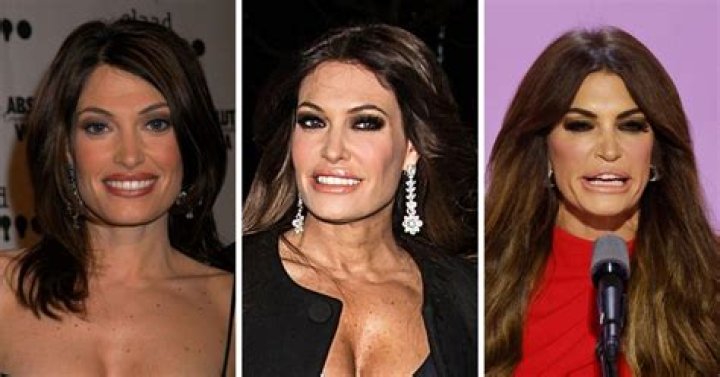 Kimberly Guilfoyle Plastic Surgery: A Comprehensive Analysis
