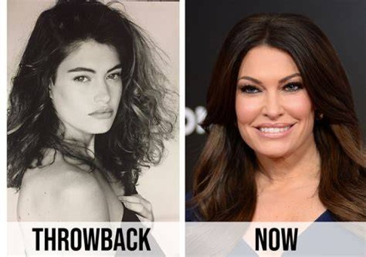 Kimberly Guilfoyle Plastic Surgery: Unveiling The Transformation
