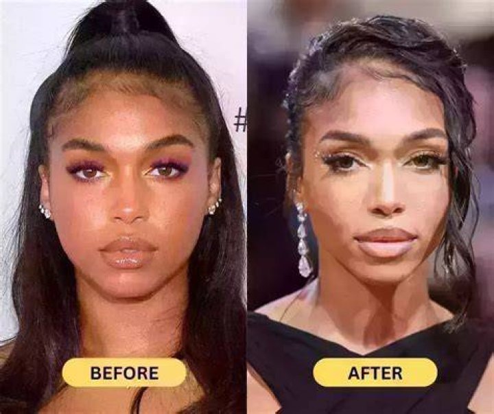 Lori Harvey Surgery: A Comprehensive Look At Her Transformational Journey