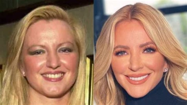 Michelle Mone Before and After Plastic Surgery!