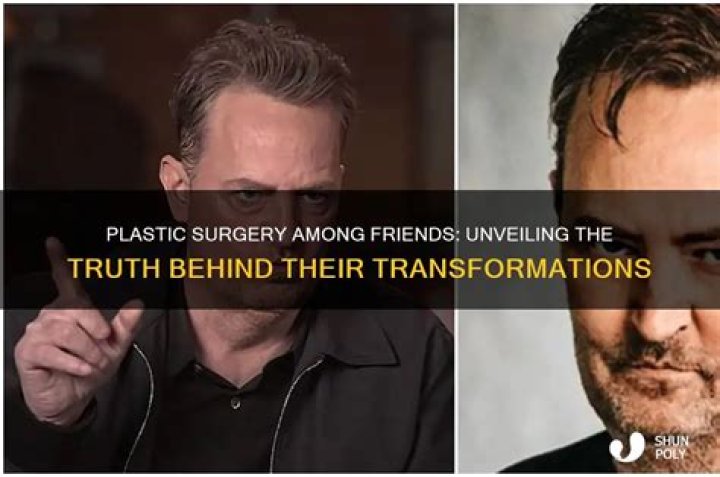 Unveiling The Truth: Herbstreit Plastic Surgery