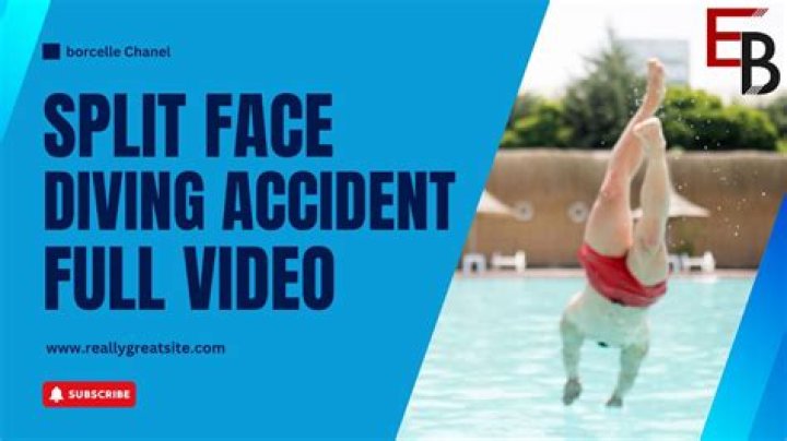Why you should avoid the head split dive accident trend